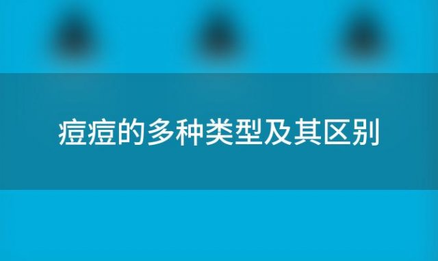 痘痘的多种类型及其区别：了解你的皮肤问题