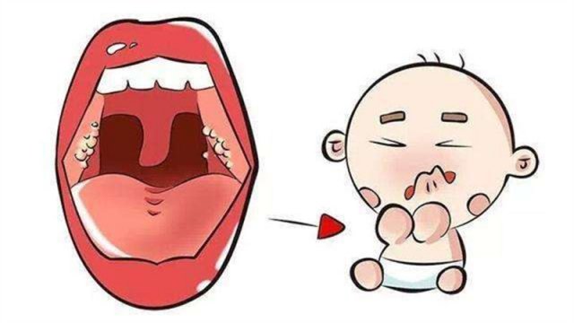 宝宝喉咙老是吼吼吼的是怎么了(宝宝喉咙里面有痰怎么化痰)