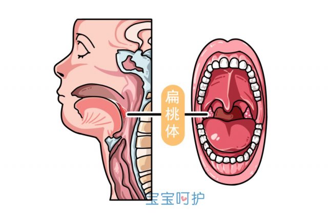 宝宝扁桃体发炎能不能吃水果，宝宝扁桃体发炎能吃什么零食